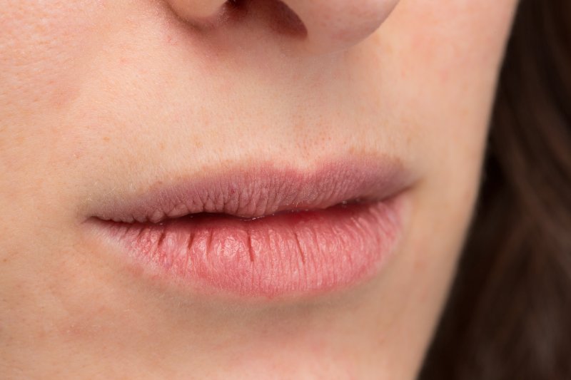 Chapped Lips Home Remedies: